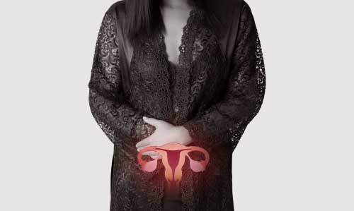 A Highly Effective Treatment for Endometriosis