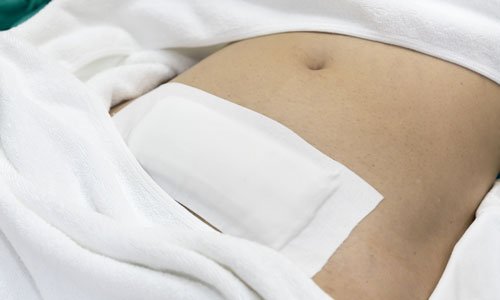 HYSTERECTOMY-WHAT-YOUR-DOCTOR-WON’T-TELL-YOU