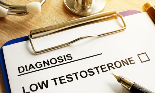 Are Low Testosterone Levels Affecting Your Brain